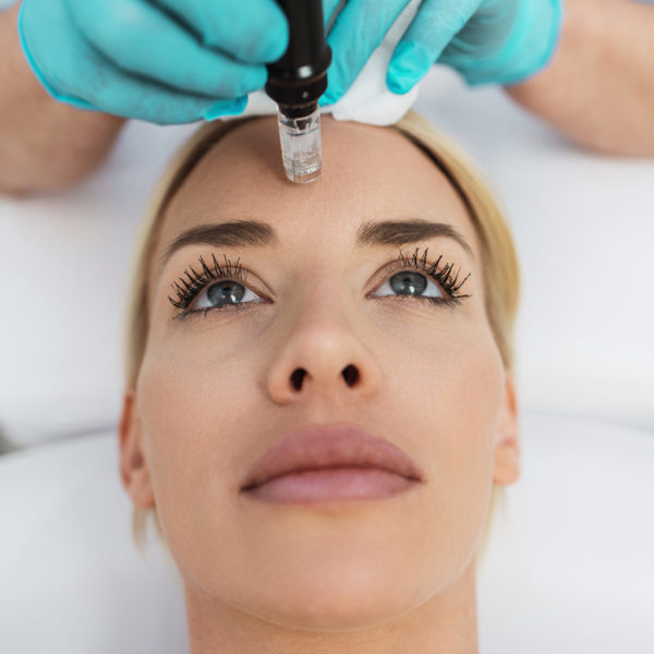 Microneedling Device